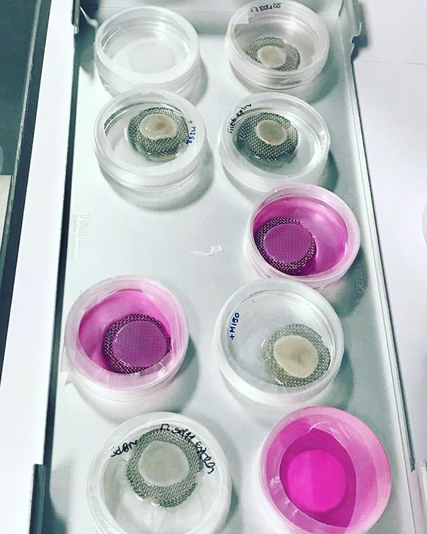 Piel reconstruida con Episkin, de L'Oréal